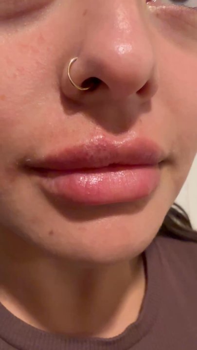 Perla MD - Medical Spas Near Me - Tijuana, BCN