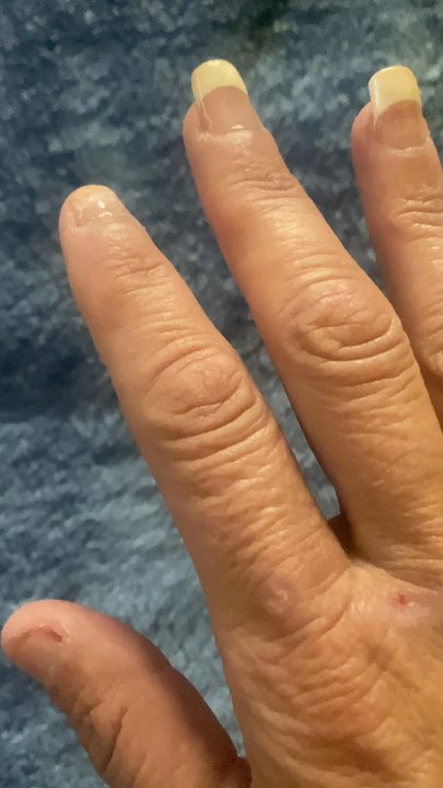 Super Spa Nails - Proof of both nails missing. - Nail Salons Near Me - Montebello, California