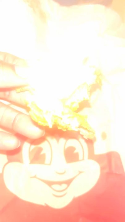 Jollibee - Definitely coming for a refund this is disgraceful behaviour  HAIR WAS UNDER THE FUCK SKIN  that's fucked bro n disgusting as hell - Fast Food Near Me - North York, Alberta