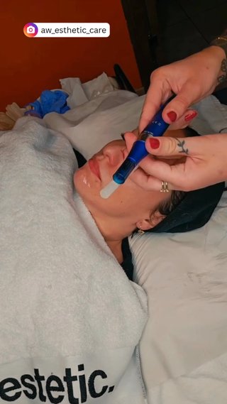  - vidéo