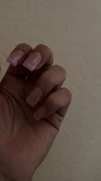 Nails 4 U - Days later and you can see how acrylic started lifting and pulling ingrown on side of left middle finger (painful and throbbing)! - Nail Salons Near Me - Cornelius, Oregon