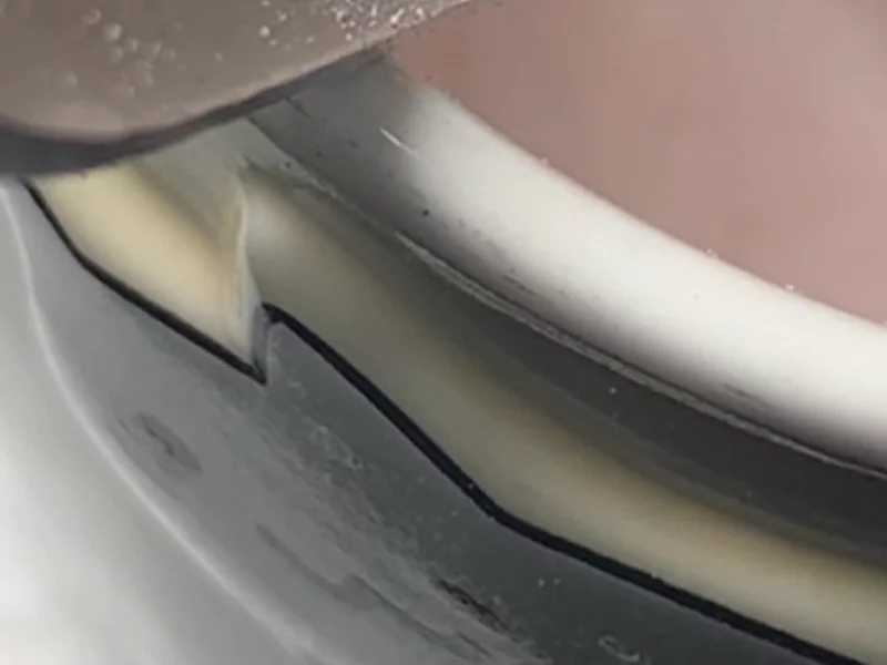 Collagen