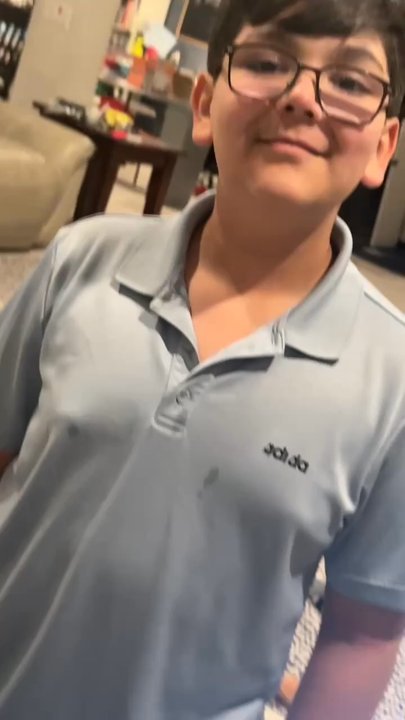 The Pass Pediatric Dental Group - My Son sending a Message of Appreciation to Dr. Wesley Okumura for helping him fix his teeth and being able to Eat Again!! - Pediatric Dentists Near Me - Beaumont, California