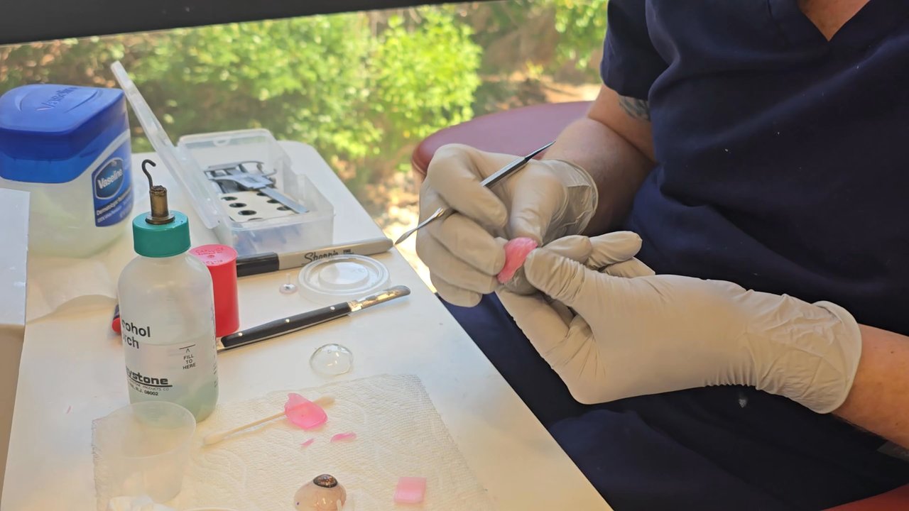 Prosthetic Illusions - Forming a mold for my new eye using wax. - Prosthetics Near Me - Lakewood, Colorado