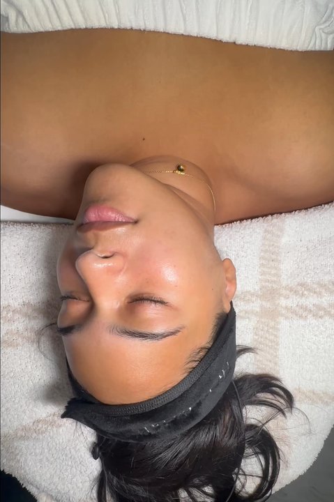 Skinishnyc - Hydrafacial GLOW - Day Spas Near Me - Bayside, New York