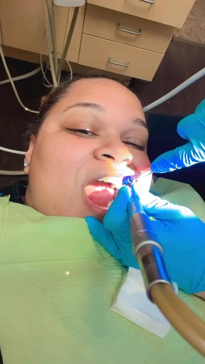 MINT dentistry | Desoto - Teeth polishing!!! - General Dentistry Near Me - Desoto, Texas