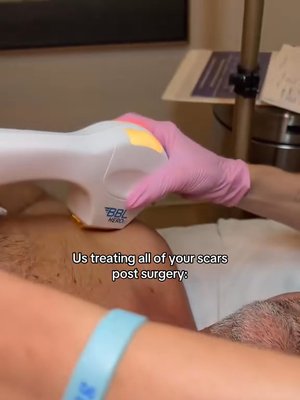 Breast Augmentation result at The Rose Clinic