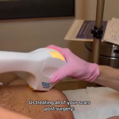 The Rose Clinic breast augmentation result — Orem, UT