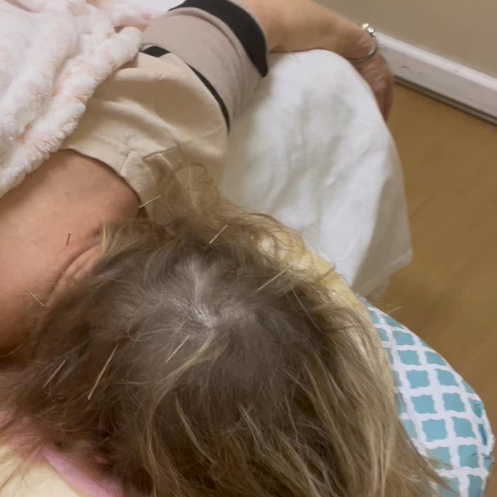Ginkgo TCM Centre - Acupuncture with herbal potion treatment really good for hair fall problem and help grow out more new hair! - Acupuncture Near Me - Spring, Texas