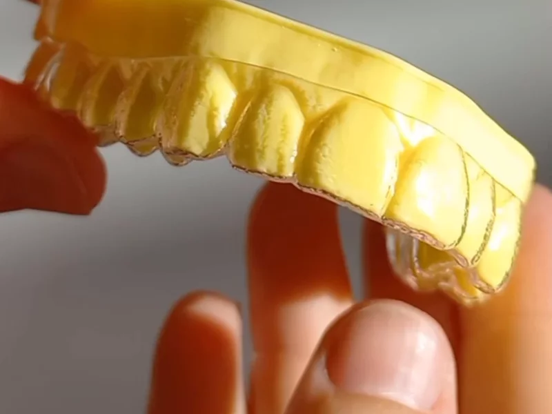 UGC Example - Dental Aligners