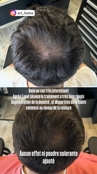  - vidéo