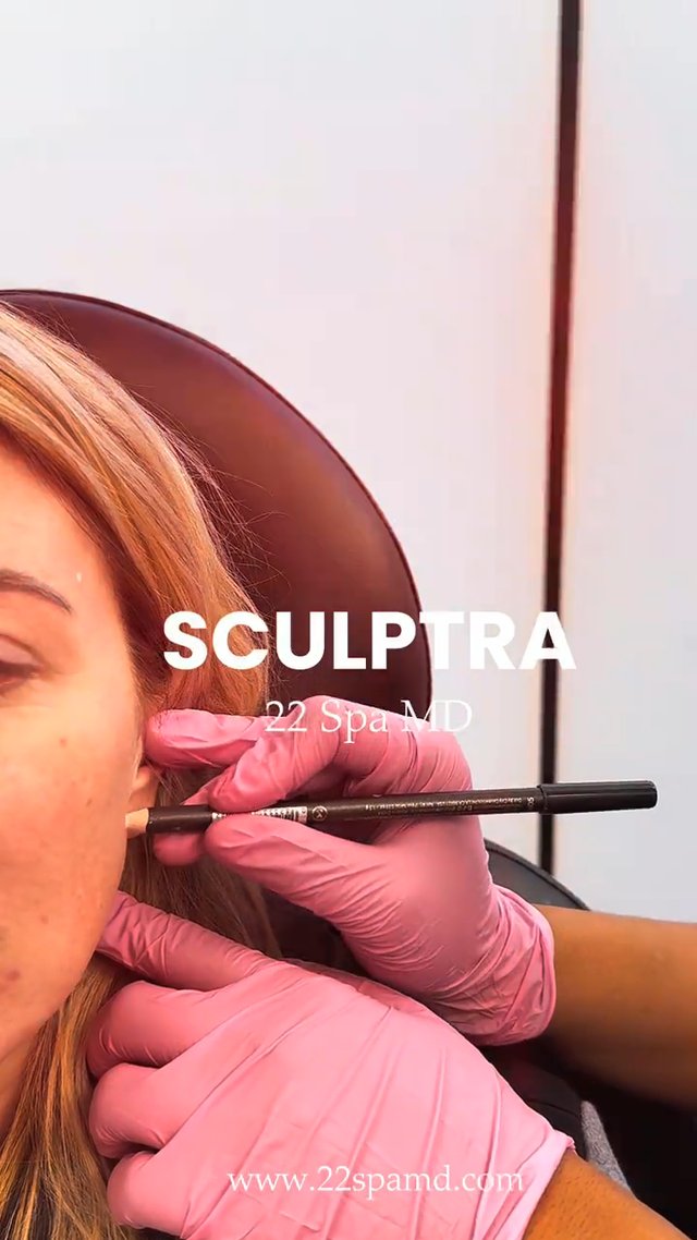 Skin Tightening result at 22 Plastic Surgery & Spa MD