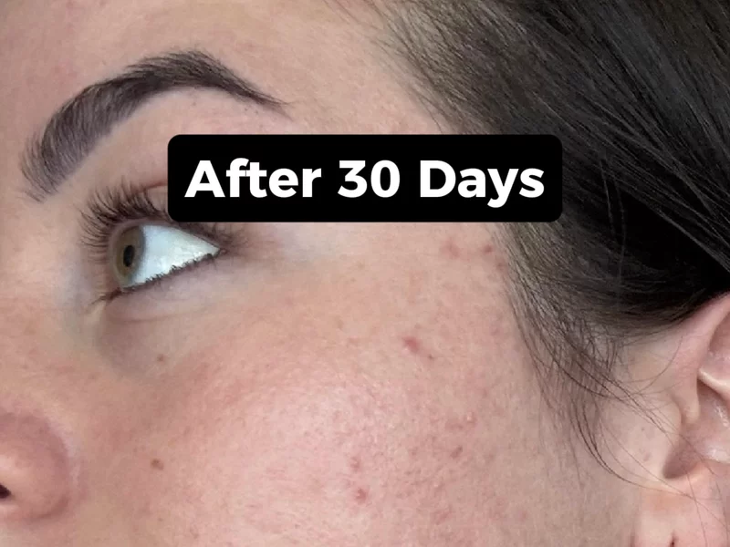 60 day skin transformation