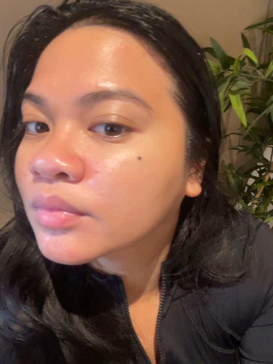 Your Spa - After hydrafacial + stem cell treatment - Skin Care Near Me - Artesia, California