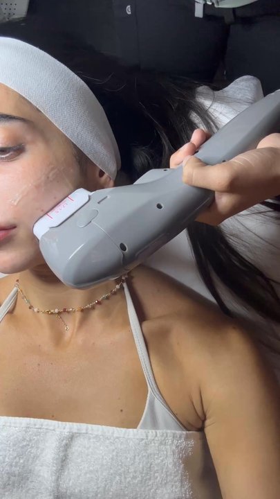 Belle Via Spa - Hifu treatment - Medical Spas Near Me - Encinitas, California