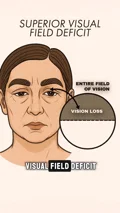 @nyfacemd on insurance for a brow lift or eyelid lift