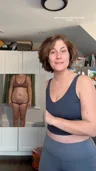 @moretolovski seven weeks after her combined operation