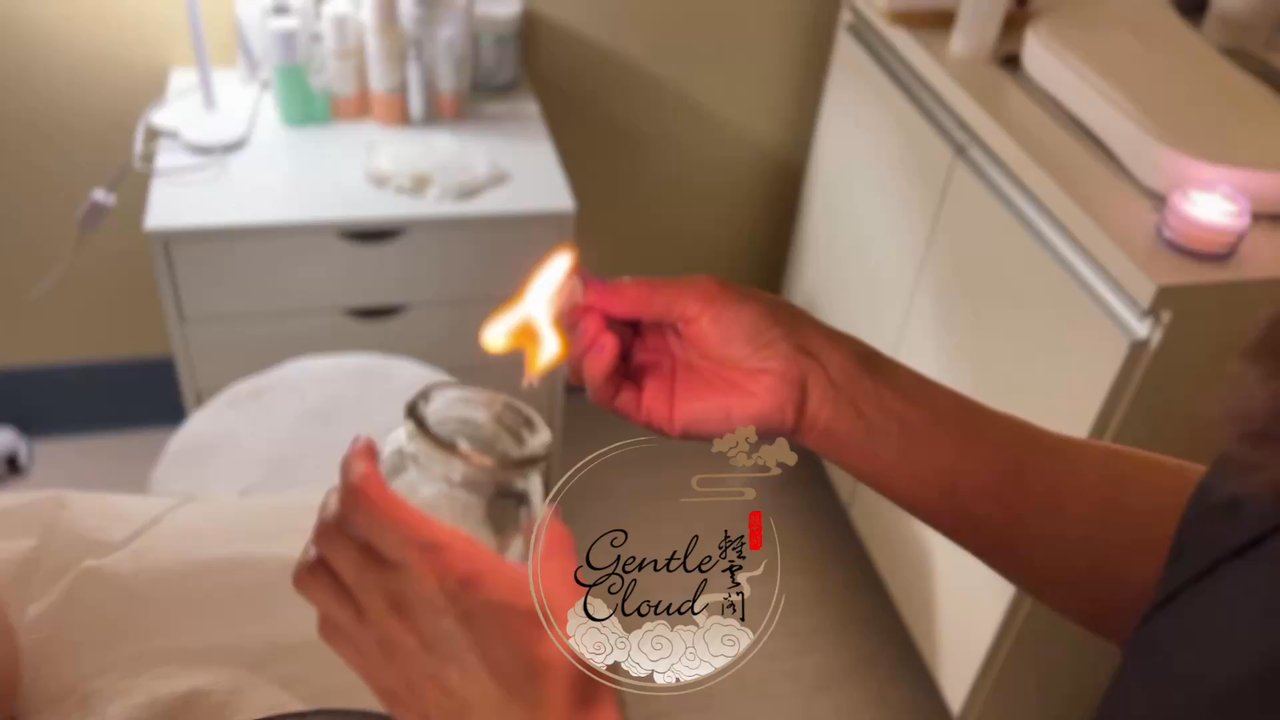 Gentle Cloud Spa - Fire cupping - Massage Near Me - Portland, Oregon
