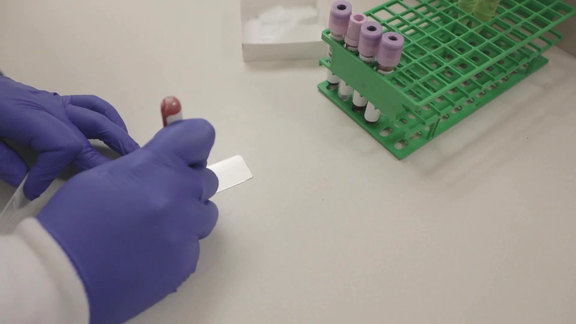 Unlocking Health: The Vital Role of Medical Lab Scientists in Patient Care