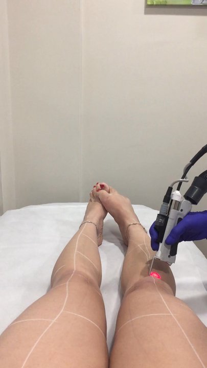 MD Laser NYC - Full legs laser hair removal - Medical Spas Near Me - New York, New York