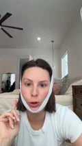 @kimberlyoconnell on choosing a deep plane neck lift