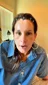 @loranrichards, about two weeks after an endoscopic brow lift