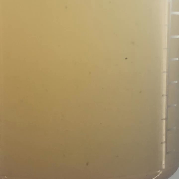 Salon 074 - Blackheads and dead skin cells collected in a waste container after hydrafacial treatment!! - Hair Salons Near Me - Sammamish, Washington