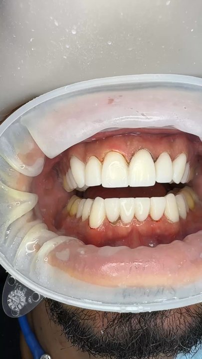 Ryan Savage, DDS - Cosmetic Dentists Near Me - Orange, California