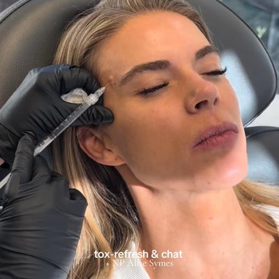 Utah Facial Plastics & UFP Hair Restoration botox result — Salt Lake City, UT