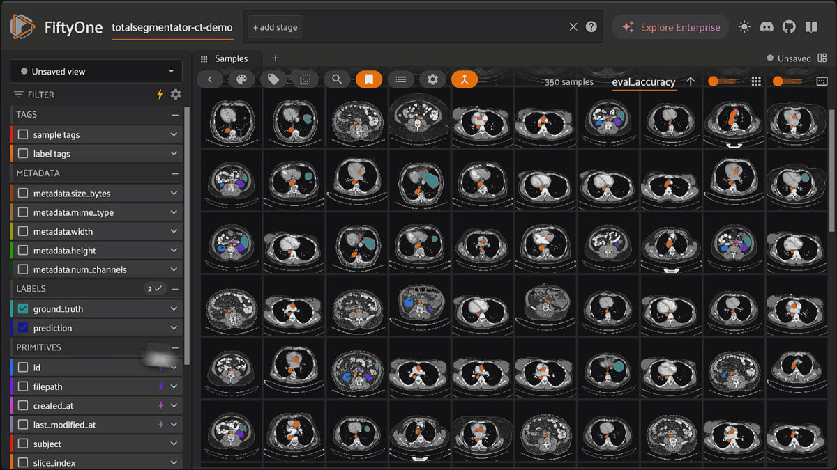 FiftyOne grid of CT predictions sorted by accuracy, worst first, floating the model's failure cases to the top.