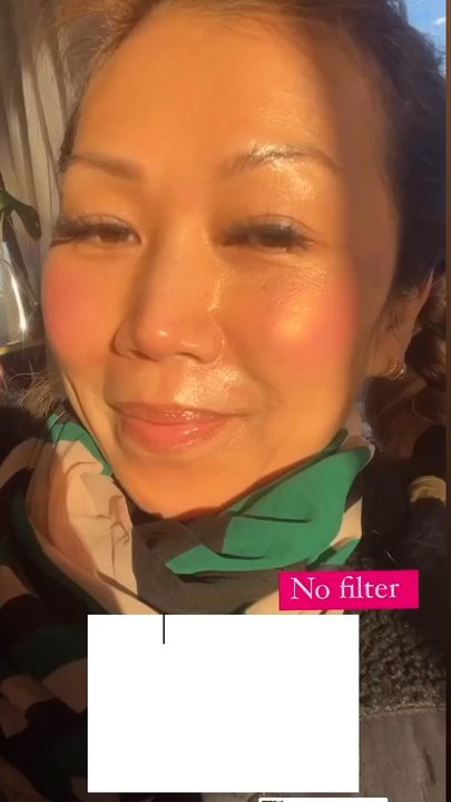 Dermapigmentation Clinic - Tattoo Removal Near Me - Burlingame , California