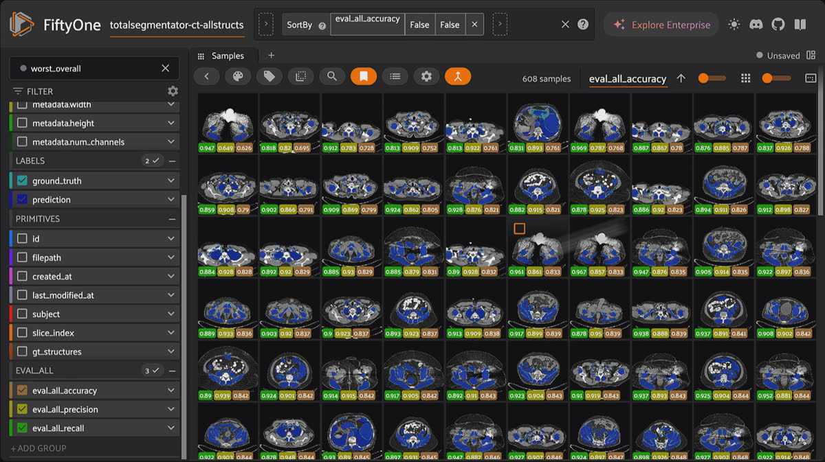FiftyOne grid of CT scans with all TotalSegmentator structures overlaid across the dataset.