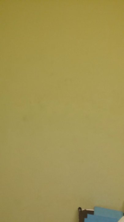 Just X-Rays - Showing how dirty it is. Last time I'm coming here. - Diagnostic Imaging Near Me - San Jose, California