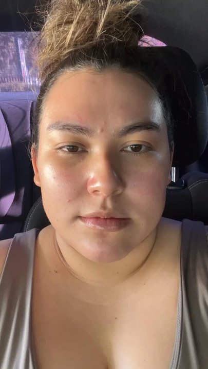 True Skin Luxury - Right after my facial - Skin Care Near Me - Concord, California