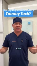 @therealdrsterry · Staged liposuction