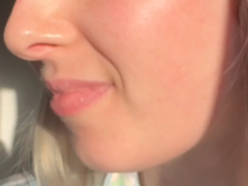 Skincare Ad