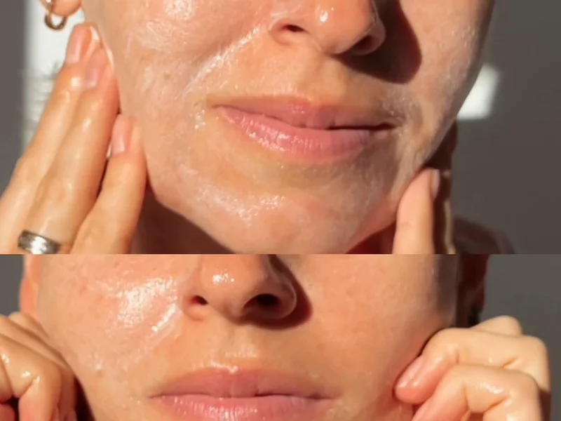 Skincare