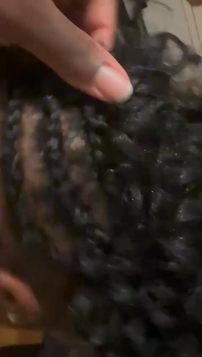 Sofia African Hair Braiding - Videos and pictures of glue on the scalp and in the hair and hair loss due to super glue being used. - Hair Extensions Near Me - San Leandro, California