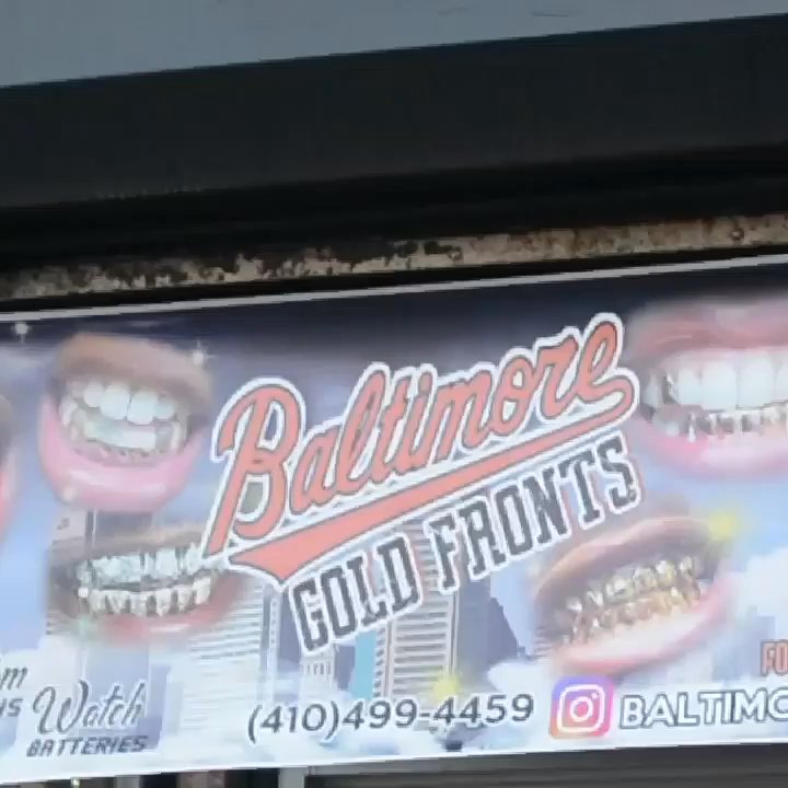Baltimore Gold Fronts - Introducing Baltimore Gold Fronts 2429 E. Monument St. Baltimore Md. 21205 410-499-4459 - Jewelry Near Me - Baltimore, Maryland