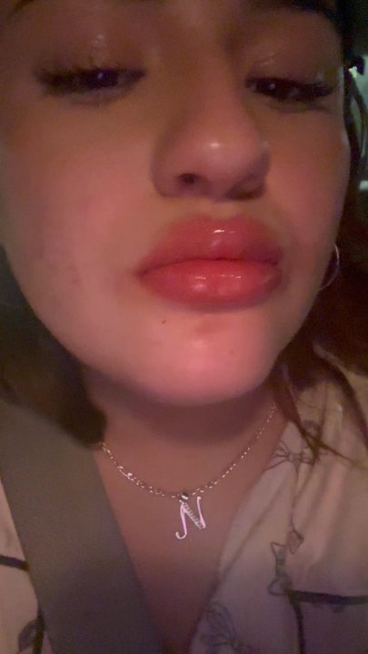 Union Beauty Lab - This was right after they were swollen but it barely hurt at all and we're so pretty! - Permanent Makeup Near Me - Irving, Texas