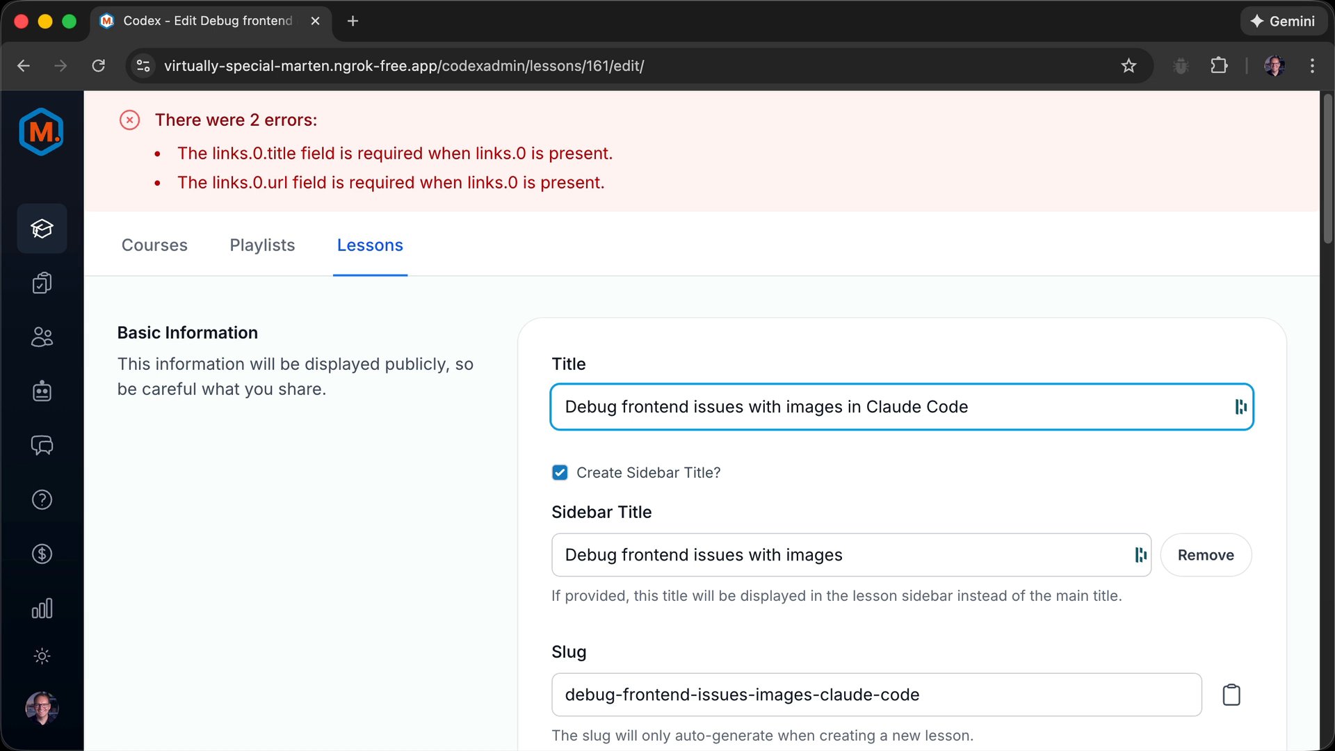 Debug frontend issues with Playwright MCP in Claude Code