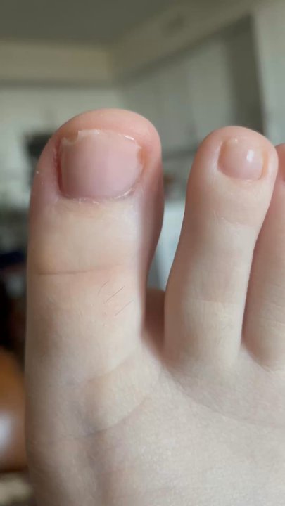 Luxury Nails Spa - Sorry for my ugly feet but this work is horrible - Nail Salons Near Me - Rancho Cucamonga, California