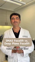 @drazizzadeh · SMAS and deep plane