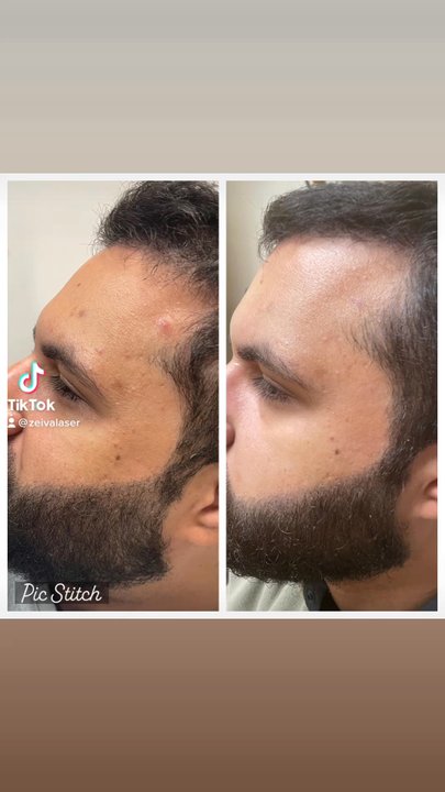 Zeiva Professional Center - Skin Care Near Me - Dearborn, Michigan