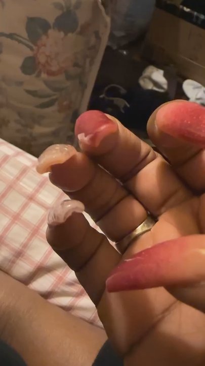 Grand Lux Day Spa Longview - Ombre nails coffin shape. Very lumpy. Uneven. Bruised cuticles. Didn't clean underneath. - Day Spas Near Me - Longview, Texas