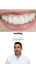 Component choice in a selected smile makeover