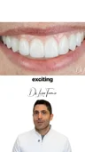 Component choice in a selected smile makeover