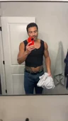 @its_michaelalisa, day 10 after gynecomastia surgery