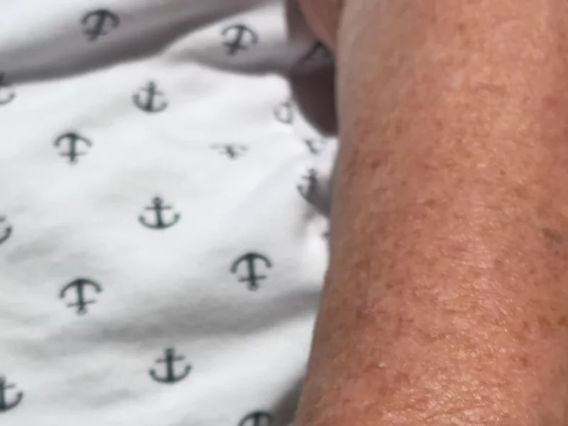Special Bracelet