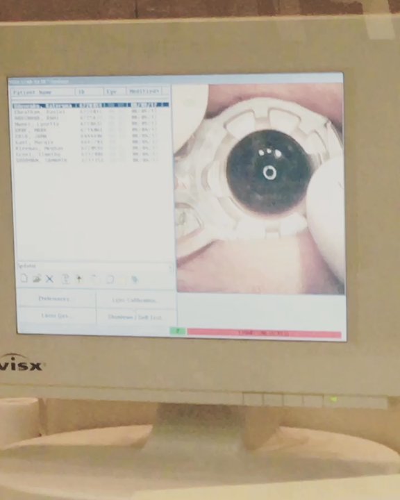 LasikPlus - This wasn't my eye but a person on my follow up, kinda cool tho, they put a clamp on your eye - Optometrists Near Me - Chicago, Illinois
